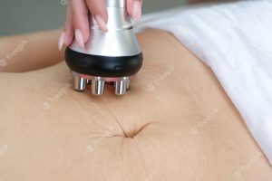 stretch-marks-skin-after-childbirth-weight-loss-rf-lifting-hardware-massage-belly-young-woman-cellulite-solution-weight-loss_170532-3332